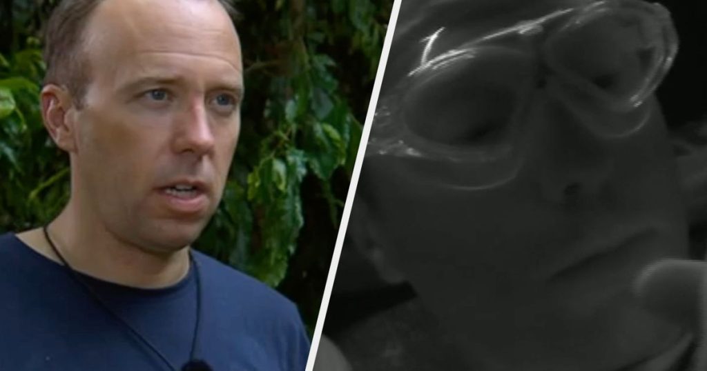 Matt Hancock Admits He's 'Starting To Enjoy' The I'm A Celebrity Bushtucker Trials