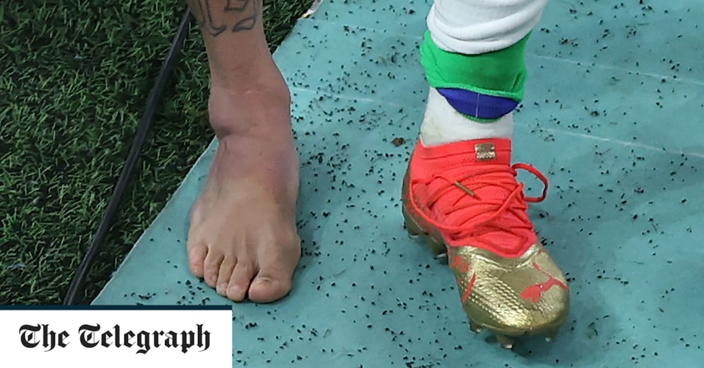 Neymar ankle harm extends his World Cup curse with Brazil Neymar ankle injury extends his World Cup curse with Brazil