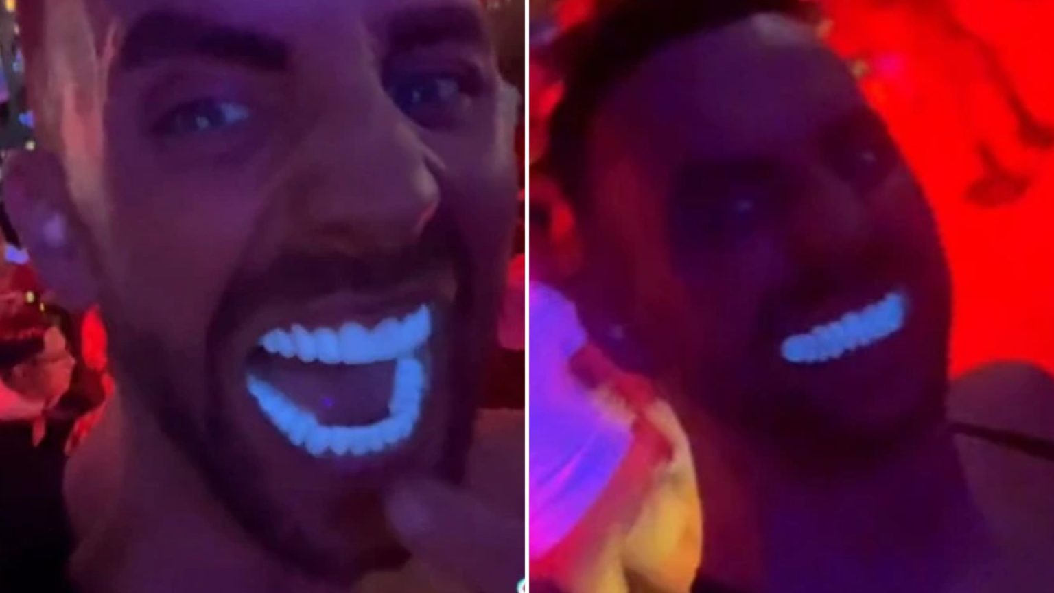 I had my teeth done in Turkey - they didn't seem that extreme until we hit the club