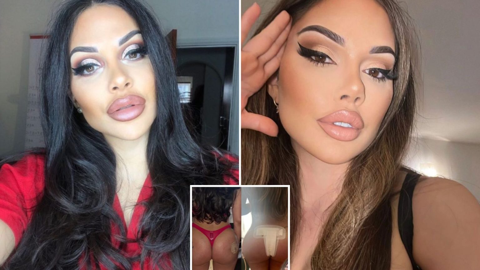 I was refused surgery by ten doctors, but I ignored their advice to conquer my insecurity. My bum ended up being torn apart by the doctors. Ten doctors refused to give me surgery but I ignored them to conquer my insecurities, my bum ended up torn apart