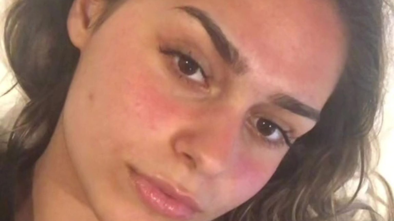 I’ve had over 12ml of filler in my lips – it’s price me £3.3k however I don’t like the way it seems, I’m completely fuming I've had over 12ml of filler in my lips - it’s cost me £3.3k but I don’t like how it looks, I’m absolutely fuming