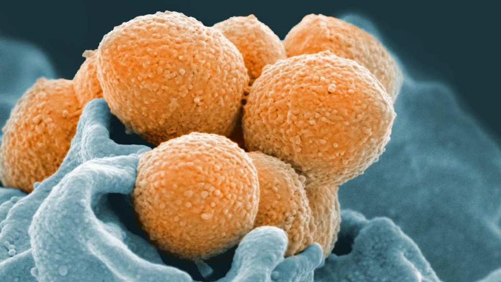 Strep A: Parents are warned to be aware of these symptoms as scarlet fever cases increase Strep A: Parents warned to look out for these symptoms as scarlet fever cases rise